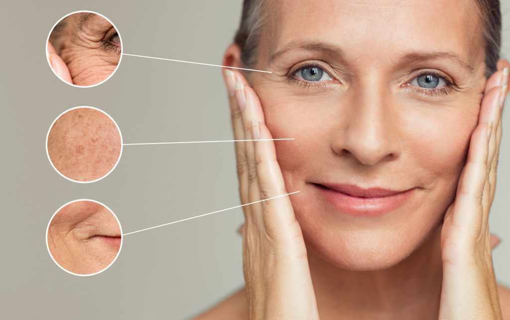aging woman skin issues